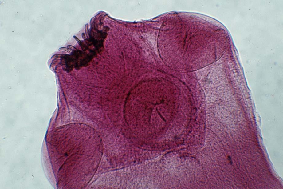 Taenia solium Scolex of the pork tapeworm.