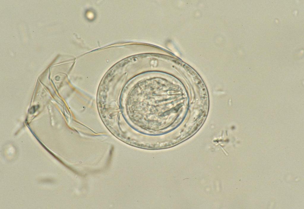 Hymenolepis nana Unstained egg with three (visible)