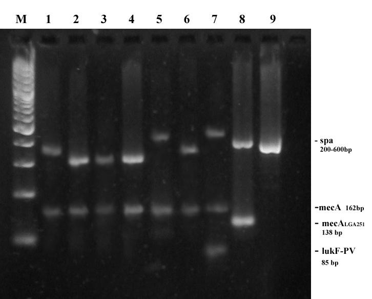 aureus nije detektovano prisustvo meca LGA251, niti Panton-Valentin leukocidin (PVL) kodirajućeg gena. M 1 2 3 4 5 6 7 Slika 2. Multipleks PCR (16S, nuc, meca).