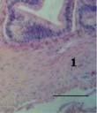 The columnar cells had large elongated nuclei situated at the base of cells goblet cells secreted mucinous substances reacted
