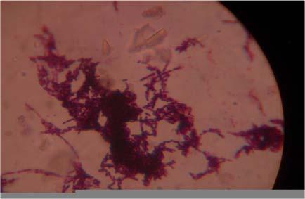 Rev. sci. tech. Off. int. Epiz., 34 (3) 11 Fig. 3 Branching filaments with septations in impression smears from lesions (Gram stain 1,000 ) Fig.