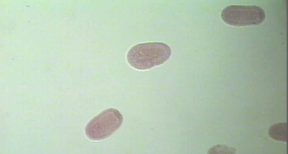 PHYLUM Cnidaria CLASS Scyphozoa Planula = Bilaterally symetrical, SEXUAL