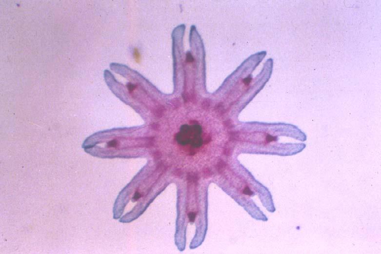 PHYLUM Cnidaria CLASS Scyphozoa