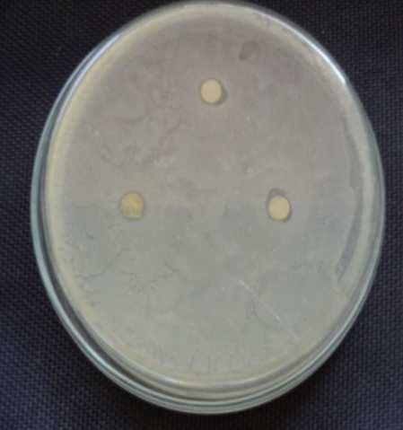 Ethyl acetate / Proteus mirabilis d. Chloroform / Staphylococcus aureus e.