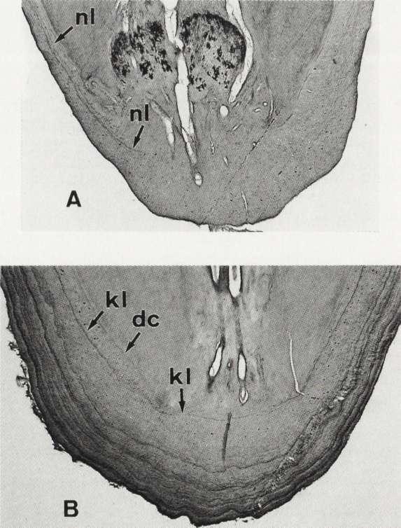 When that internal line was continuous, it was too close to the dentin-cementum junction (Fig. IB), and could be well differentiated from the other continuous lines in older specimens.