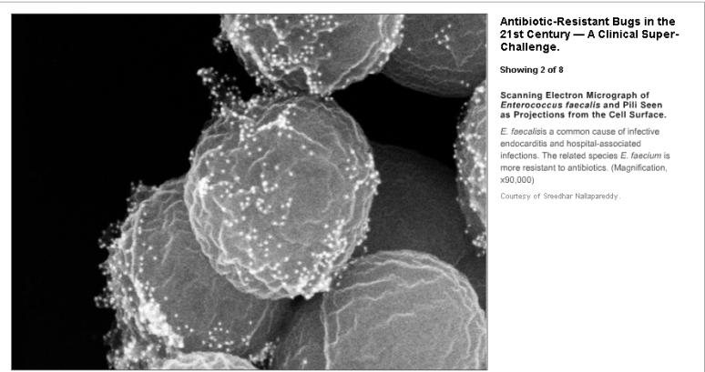 LEARNING OBJECTIVES ANTIMICROBIAL USES AND ABUSES Goodbye to the Antibiotic Era? Glenn D.