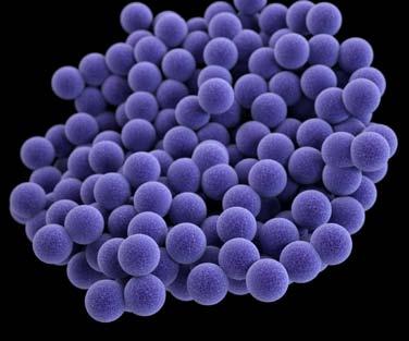 METHICILLIN-RESISTANT STAPHYLOCOCCUS AUREUS (MRSA) 80,461 11,285 SEVERE MRSA INFECTIONS PER YEAR DEATHS FROM MRSA PER YEAR THREAT LEVEL SERIOUS This bacteria is a serious concern and requires prompt