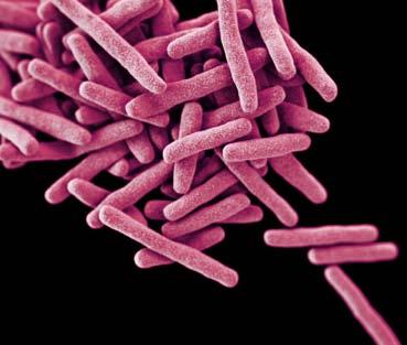 DRUG-RESISTANT TUBERCULOSIS 1,042 DRUG-RESISTANT TUBERCULOSIS CASES IN 2011 (U.S.) 10,528 TUBERCULOSIS CASES IN 2011 (U.S.) THREAT LEVEL SERIOUS This bacteria is a serious concern and requires prompt and sustained action to ensure the problem does not grow.