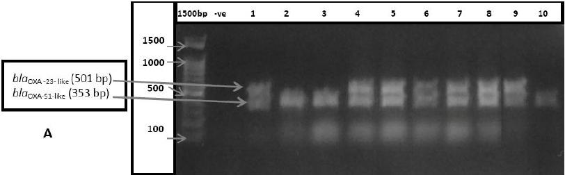 Fig. 1: Detection of genes encoding OXA carbapenemase in Acinetobacter baumannii by multiple PCR A-Lane 1: Ladder (1500bp); Lane -ve: (ddh 2 O); Lane 3-13: Acinetobacter baumannii; B-Lane L: Ladder