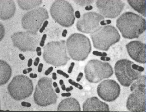 Yersinia pestis: Plague gram negative oval bacillus, bipolar staining