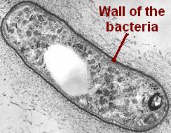 Action of antibiotics Example of action Bacteria in general are protected by a wall Some antibiotics