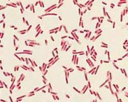 (C. diff) is a Gram positive rod Gram negative Most are baccili, rod-shaped