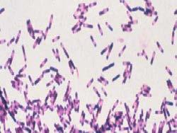 Clostridium difficile Gram positive bacillus under microscope Cannot multiple