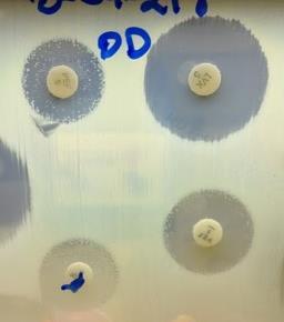 13 4 2 1 2 3 4 5 6 7-2 -4-6 - Isolate # Three lots of pefloxacin disks tested - Significantly larger zones with Oxoid disks vs. BD and MAST (p<.