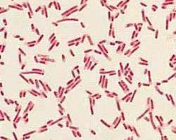 Common Types of Bacteria Gram positive Most are cocci, round bacteria