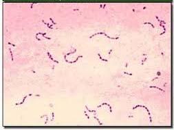 diff) is a Gram positive rod Gram negative Most are bacilli, rod-shaped