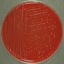 Na krvnom agaru obrazuje pojedinačne, sitne, providne kolonije sa alfa, beta i gama hemolizom (Slika 3). Slika 3. Izgled kolonija Streptococcus agalactiae na krvnom agaru (www.