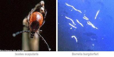 Lyme disease is an infection caused by Borrelia burgdorferi, a member of the family of corkscrew-shaped bacteria known as spirochetes and is transmitted by ticks.