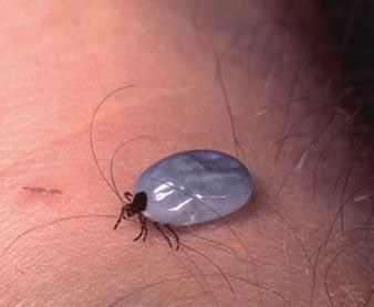 Human Louse (adult, nymph, and egg attached to hair shaft) Commonly found: people and clothing Head and body lice are very small,