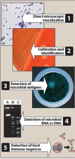 Organism s identity Characterizing the organism is central to selection of the proper drug. it is essential to obtain a sample culture of the organism prior to initiating treatment.