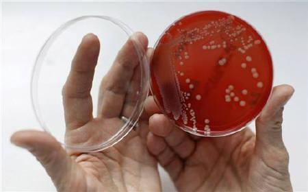 Penicillin resistance Bacteria produce enzymes