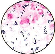 Methicillin Resistant Staphylococcus Aureus (MRSA) Achievement in Al-Mafraq Hospital Abu Dhabi, UAE By: Mr.