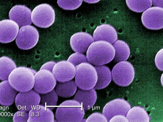 Staphylococcus aureus lives in the noses of ~25% of humans