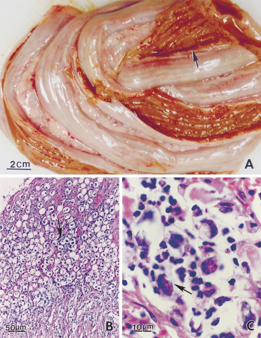 KINNE ET AL. COCCIDIOSIS IN CAMELS 549 FIGURE 1. Lesions and coccidia in colon of camels. (A) Hemorrhages in colon mucosa (arrows). Unstained. (B) Masses of coccidian oocysts (arrow) in a raised area.