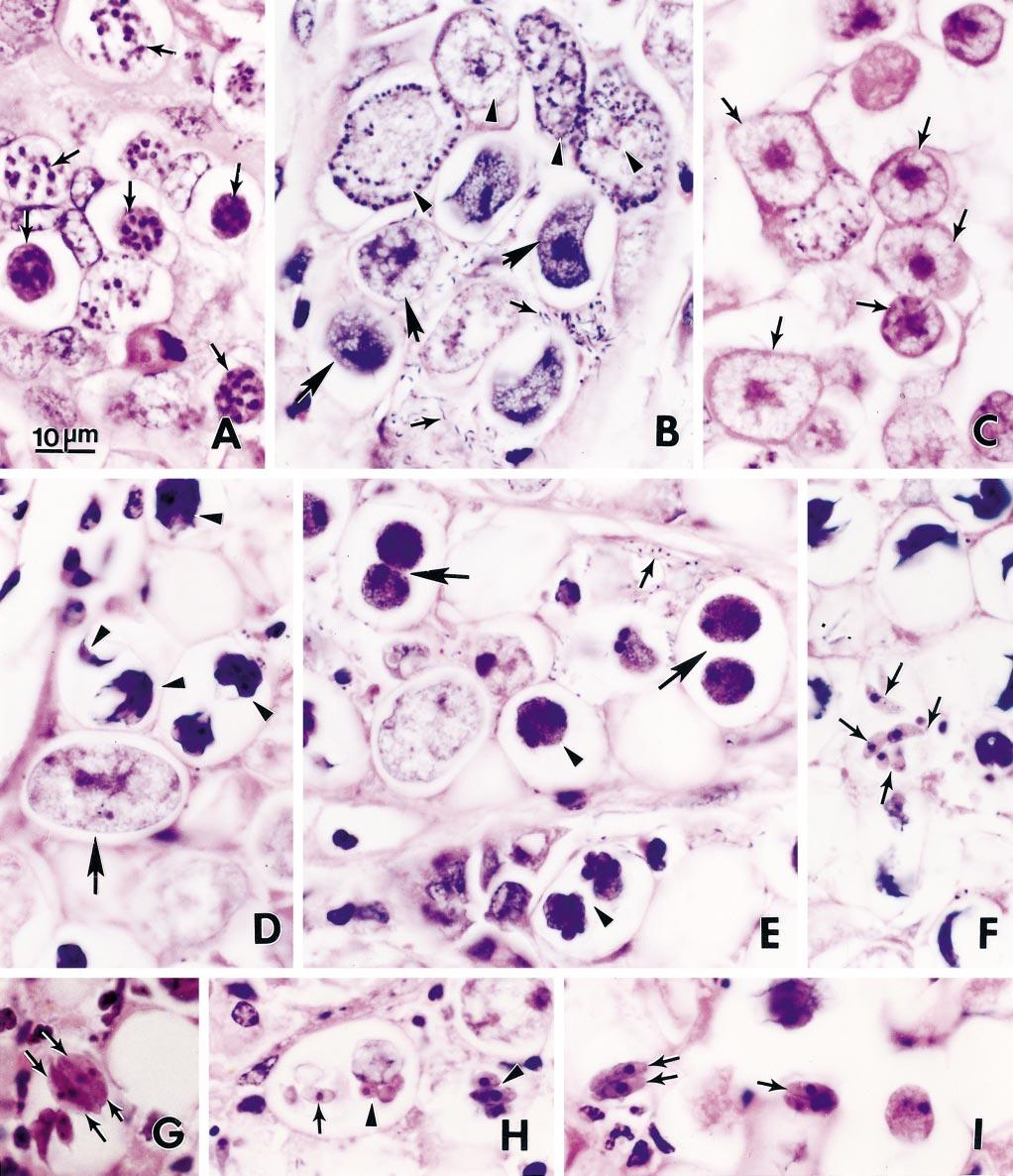 550 THE JOURNAL OF PARASITOLOGY, VOL. 88, NO. 3, JUNE 2002 FIGURE 2. Coccidian stages in sections of colon of camels. Hematoxylin and eosin stain. Bar applies to all figures.