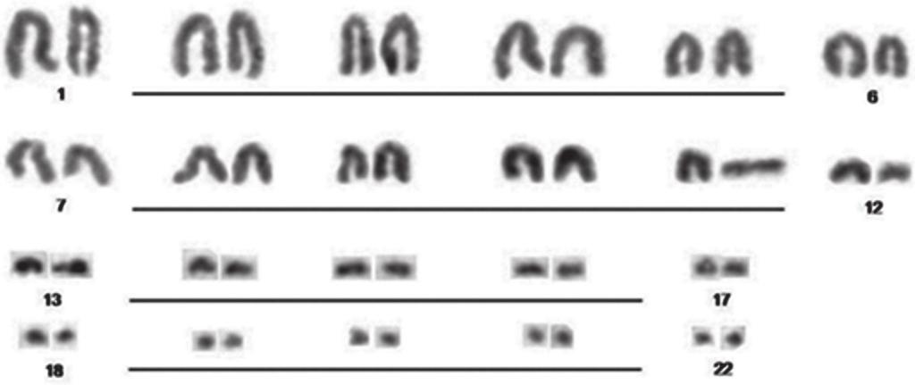 A new karyotypic formula for the genus Amphisbaena Figure 2. Karyotype of Amphisbaena bolivica (2n = 44) using conventional procedure.