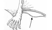 [Underside of wing not furred from side to elbow.] Myotis volans 13 13a 13b Tail does NOT extend beyond uropatagium. Thumb length < 4.2mm. Braincase has an abruptly rising profile (convex forehead).