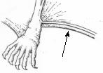 13a) Tail often extends slightly beyond uropatagium. Thumb length > 4.2mm. No distinct rise in braincase profile (sloping forehead). Length across snout 1.5 times width across nostrils.