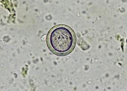 D i a g n o s t i c s C O N T I N U E D 1 2 Taenia species egg, 40 mcm Physaloptera species egg, 45 30 mcm CENTRIFUGATION FECAL FLOTATION For diagnosis of parasitic infections when the diagnostic