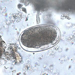 Sarcoptes scabiei Diagnosis: Centrifugal fecal flotation using sugar May