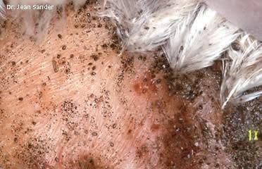 Pox & Newcastle Disease Mites readily bite humans Diagnosis: Mites ~ 1mm Found around vent area of hens
