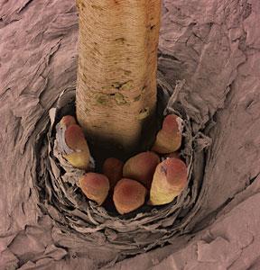 very common Demodex cati, rare Morphology Microscopic