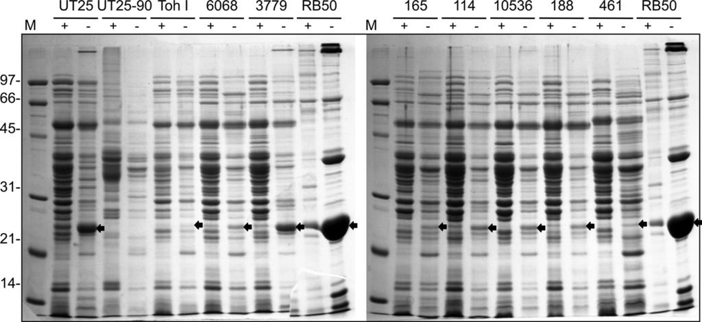 VOL. 193, 2011 IRON STARVATION RESPONSE IN BORDETELLA PERTUSSIS 4809 FIG. 9. Secretion profiles of various B. pertussis strains. Low-passage and high-passage strains of B.