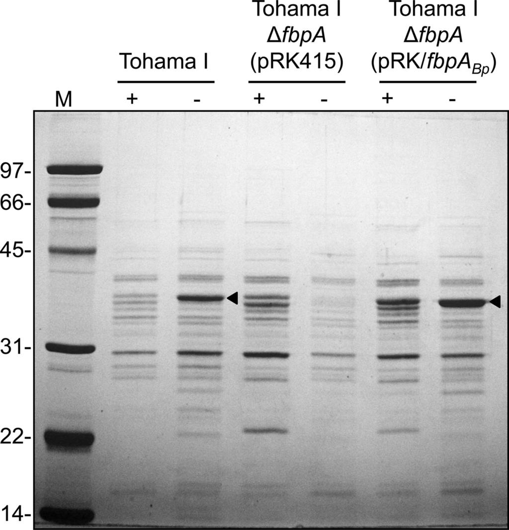 VOL. 193, 2011 IRON STARVATION RESPONSE IN BORDETELLA PERTUSSIS 4805 frame fbpa deletion mutations were constructed in strains Tohama I and UT25. Both B.