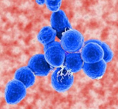 Serious Threats Multidrug-resistant Acinetobacter
