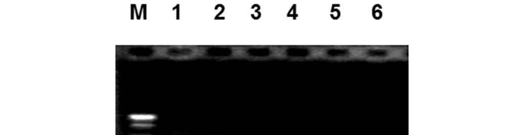 On the other hand PAT mean reciprocal sera antibody titers at 1, 2, 3, 4, 5, 6, 7 and 8 weeks after infection were recorded as 112±13, 200±41, 275±25, 325±48, 425±25, 287±31, 250±29 and 175±25,
