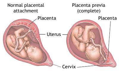 Placental Mammals Placental mammals completely develop their young inside of the mother.