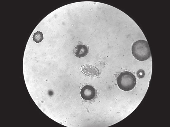 Jaja ankilostomatida su ustanovljena kod jedne ženke (Zemun), starosti 2 godine, što je iznosilo 2% od ukupnog broja ispitanih jedinki (1/50) (Slika 3).
