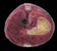 Posterior cerebral artery (B), Temporal artery (C) Images middle: Spinal cord (A), Vena cava (B), Liver (C), Stomach (D), Aorta (E)