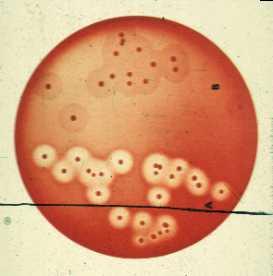 Contagious Pathogens Staphylococcus aureus Most prevalent contagious pathogen Most often subclinical Strain differences in contagiousness & effect on mammary