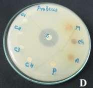 Staphylococcus aureus, D - roteus