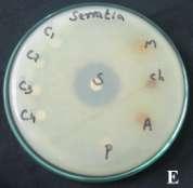 F-scherichia coli, G - Bacillus