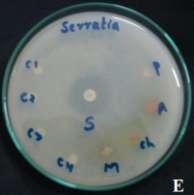 A- Salmonella typhi, B - seudomonas