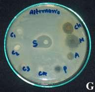 F-scherichia coli,