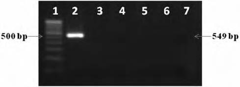 PRABHU et al.: DETECTION OF STREPTOCOCCAL ISOLATES FROM SUBCLINICAL BOVINE MASTITIS 211 Fig. 3 PCR amplification of 549 bp 16S rrna gene of S. dysgalactiae isolated from bovine mastitis cases.