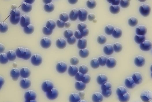 Klebsiella sp. and Enterobacter sp. Klebsiella sp. are large Gram-negative, non-motile rods. Enterobacter sp. are large Gramnegative, motile rods. Klebsiella sp. grows with large dark blue/dark purple colonies.